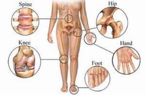 joint-pain-symptoms